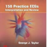 150 Practice ECGs