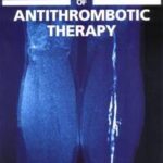 ABC of Antithrombotic Therapy (ABC)