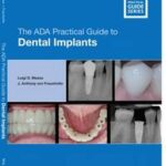 The ADA Practical Guide to Dental Implants