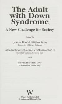 adult-down-syndrome-jean-rondall-alberto-9781861563972
