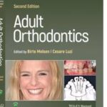 Adult Orthodontics