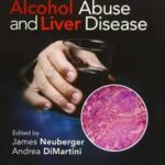 Alcohol Abuse and Liver Disease