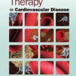 Antiplatelet Therapy in Cardiovascular Disease