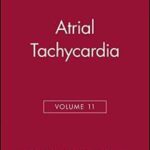 Atrial Tachycardia