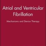 Atrial and Ventricular Fibrillation