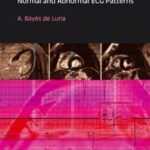Basic Electrocardiography
