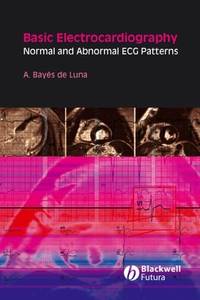 basic-electrocardiography-normal-abnormal-ecg-patterns-9781405175708