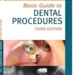 Basic Guide to Dental Procedures