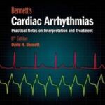 Bennett's Cardiac Arrhythmias