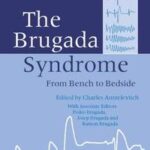 The Brugada Syndrome