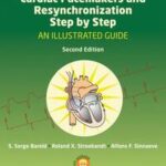 Cardiac Pacemakers and Resynchronization Step by Step