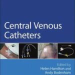 Central Venous Catheters