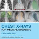 Chest X-Rays for Medical Students