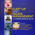 Cleft Lip and Palate Management