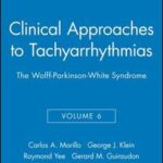 Clinical Approaches to Tachyarrhythmias, The Wolff-Parkinson-White Syndrome
