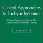Clinical Approaches to Tachyarrhythmias, Clinical Aspects of Implantable Cardioverter-Defibrillator Therapy