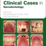 Clinical Cases in Geriatric Dentistry