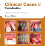 Clinical Cases in Periodontics