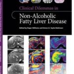 Clinical Dilemmas in Non-Alcoholic Fatty Liver Disease