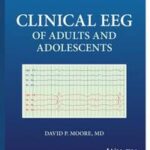 Clinical EEG of Adults and Adolescents