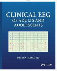 clinical-eeg-adults-adolescents-david-p-9781394315345