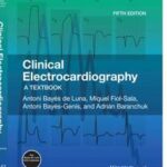 Clinical Electrocardiography