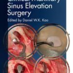 Clinical Maxillary Sinus Elevation Surgery