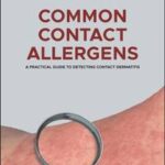 Common Contact Allergens