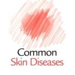 Common Skin Diseases