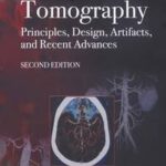 Computed Tomography Principles, Design, Artifacts, and Recent Advances
