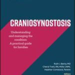 Craniosynostosis: Understanding and Managing the Condition