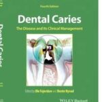 Dental Caries