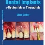 Dental Implants for Hygienists and Therapists