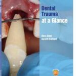 Dental Trauma at a Glance
