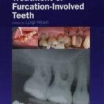 Diagnosis and Treatment of Furcation-Involved Teeth