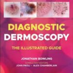 Diagnostic Dermoscopy - The Illustrated Guide