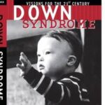 Down Syndrome