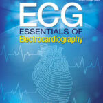 ECG: Essentials of Electrocardiography