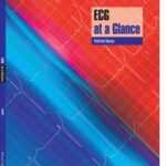 ECG at a Glance