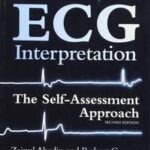 ECG Interpretation