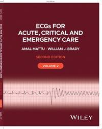 ecgs-acute-critical-emergency-care-volume-9781119986287