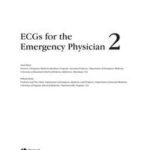 ECGs for the Emergency Physician 2