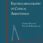 Electrocardiography of Clinical Arrhythmias