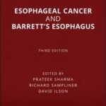 Esophageal Cancer and Barrett's Esophagus