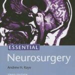 Essential Neurosurgery