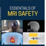 Essentials of MRI Safety