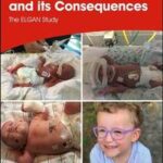 Extremely Preterm Birth and Its Consequences