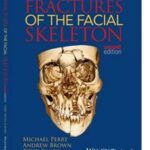 Fractures of the Facial Skeleton