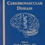 Genetics of Cerebrovascular Disease