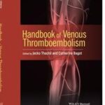 Handbook of Venous Thromboembolism